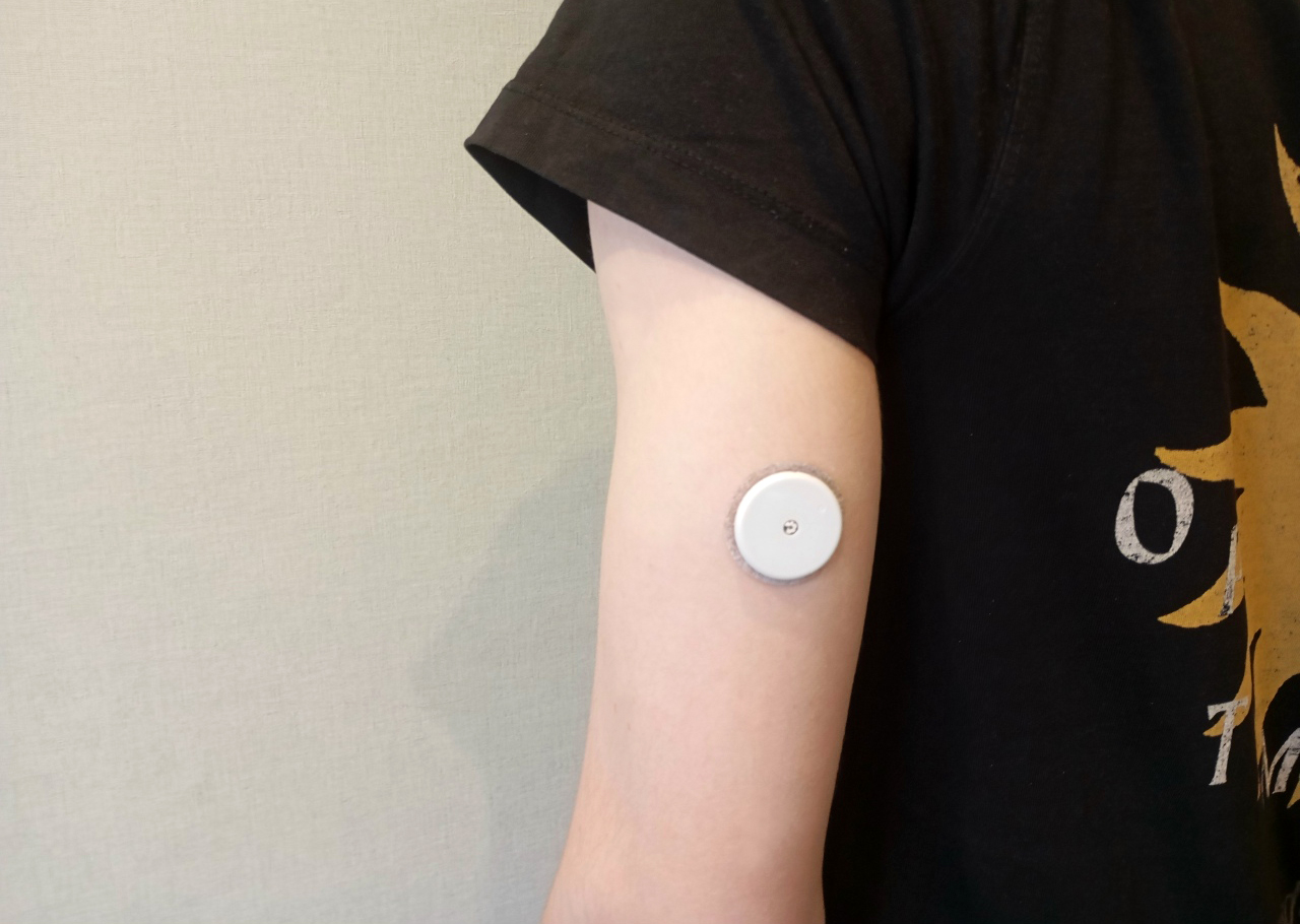 Рязанский регион получит более 55 миллионов рублей на поддержку пациентов с сахарным диабетом